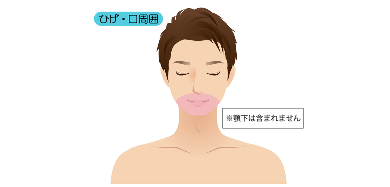 脱毛箇所 男性(ひげ・口周囲)