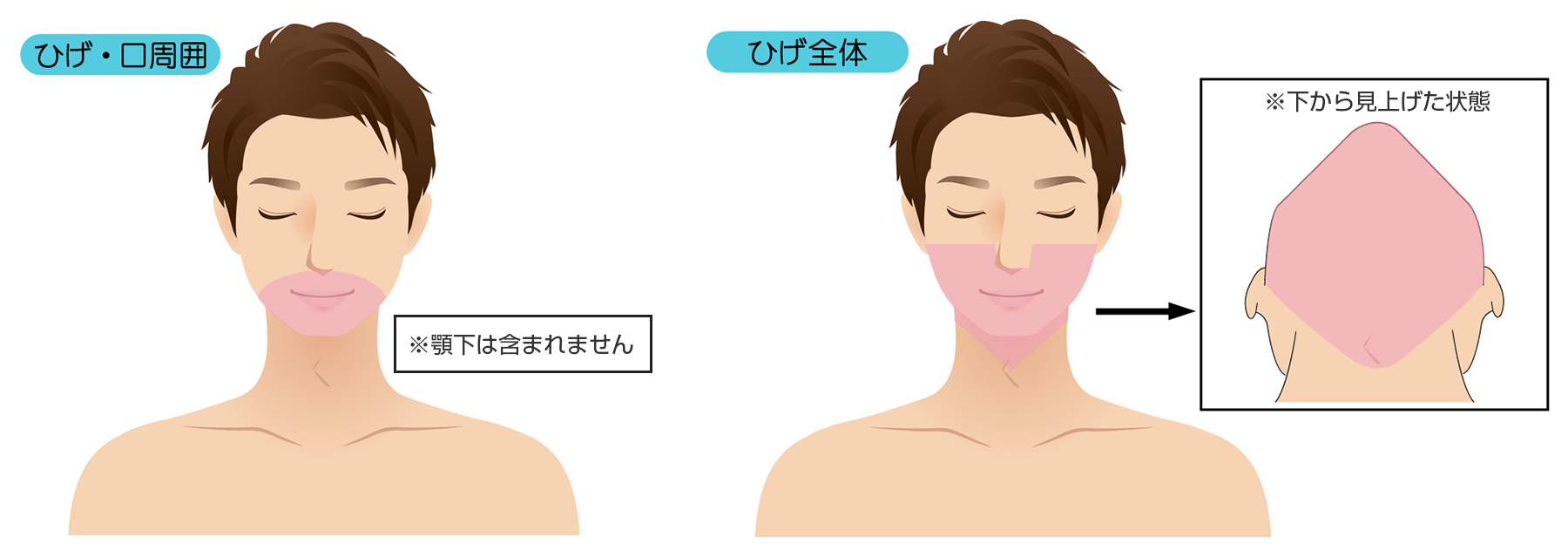 脱毛箇所 男性(ひげ・口周囲・ひげ全体)