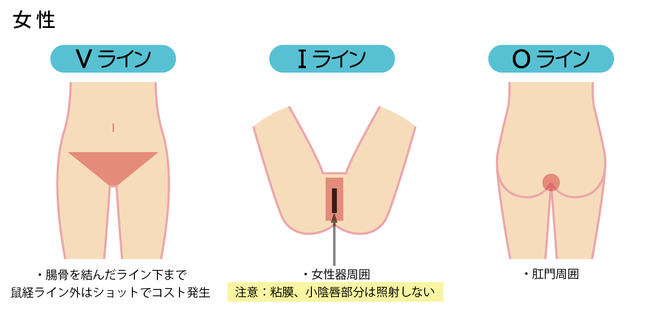 脱毛箇所 女性(Vライン・Iライン・Oライン)